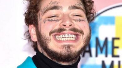 post malone teeth
