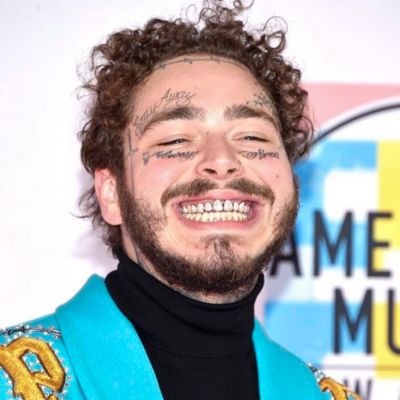 post malone teeth